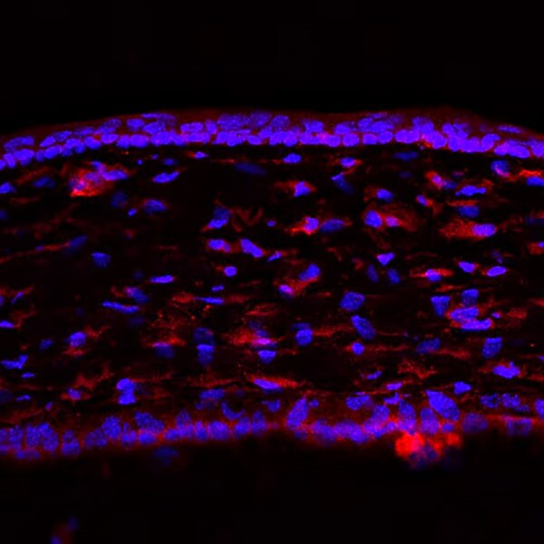 IF of P10 mouse cornea stained with DSHB antibody AFFN-IGFBP2-9D9 against IGFBP2 (red) and DAPI (blue). Image credit: Lachke Laboratory, University of Delaware.